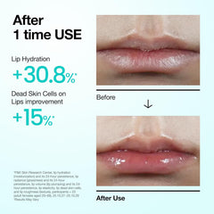 Anua PDRN Lip Serum - 10ml