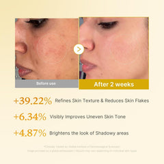 Medicube Kojic Acid Turmeric Resurfacing Toner - 250ml