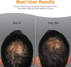 Viviscal Man Hair Nourishment Supplements - 180 Tablets (3 Months Supply)